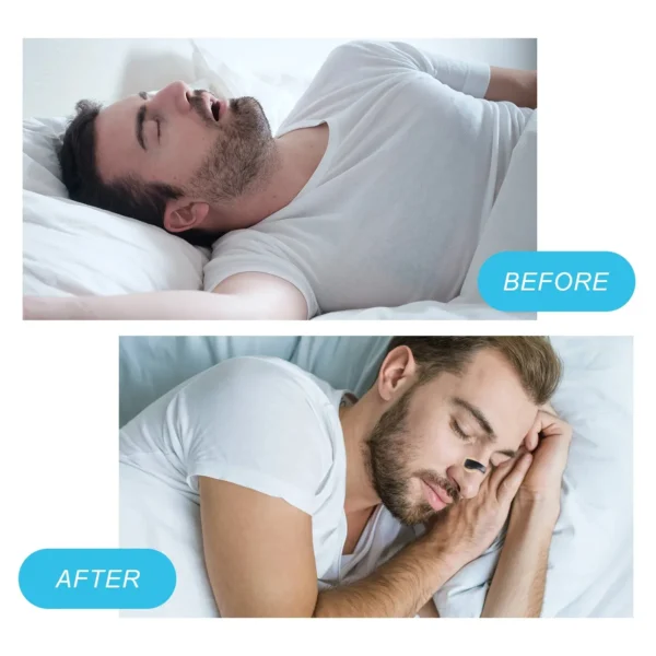 Anti Snoring Nose Strips,Boost Oxygen Intake Magnetic Nasal Dilator,Sleep Nasal Breathing Dilators Starter Kit - Image 3